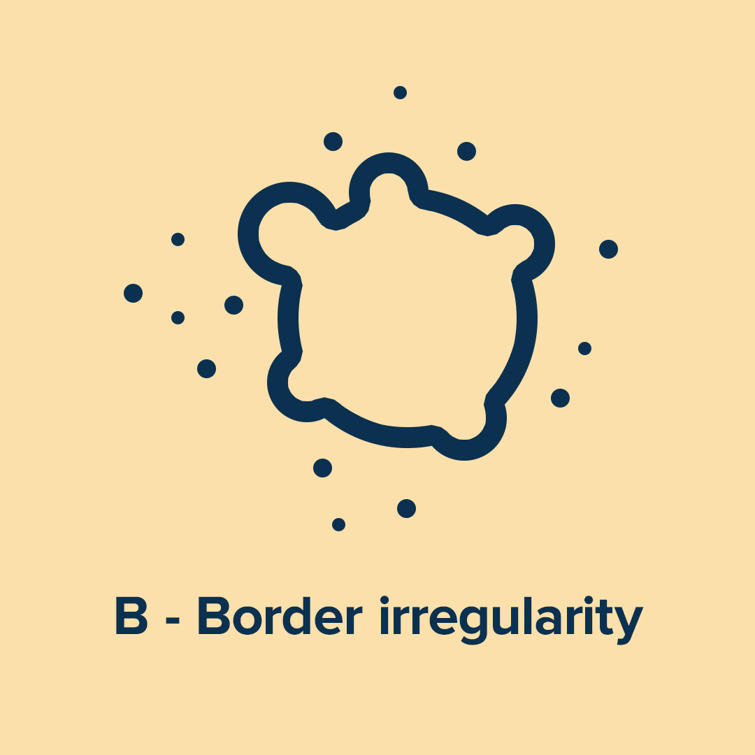 B - Border irregularity